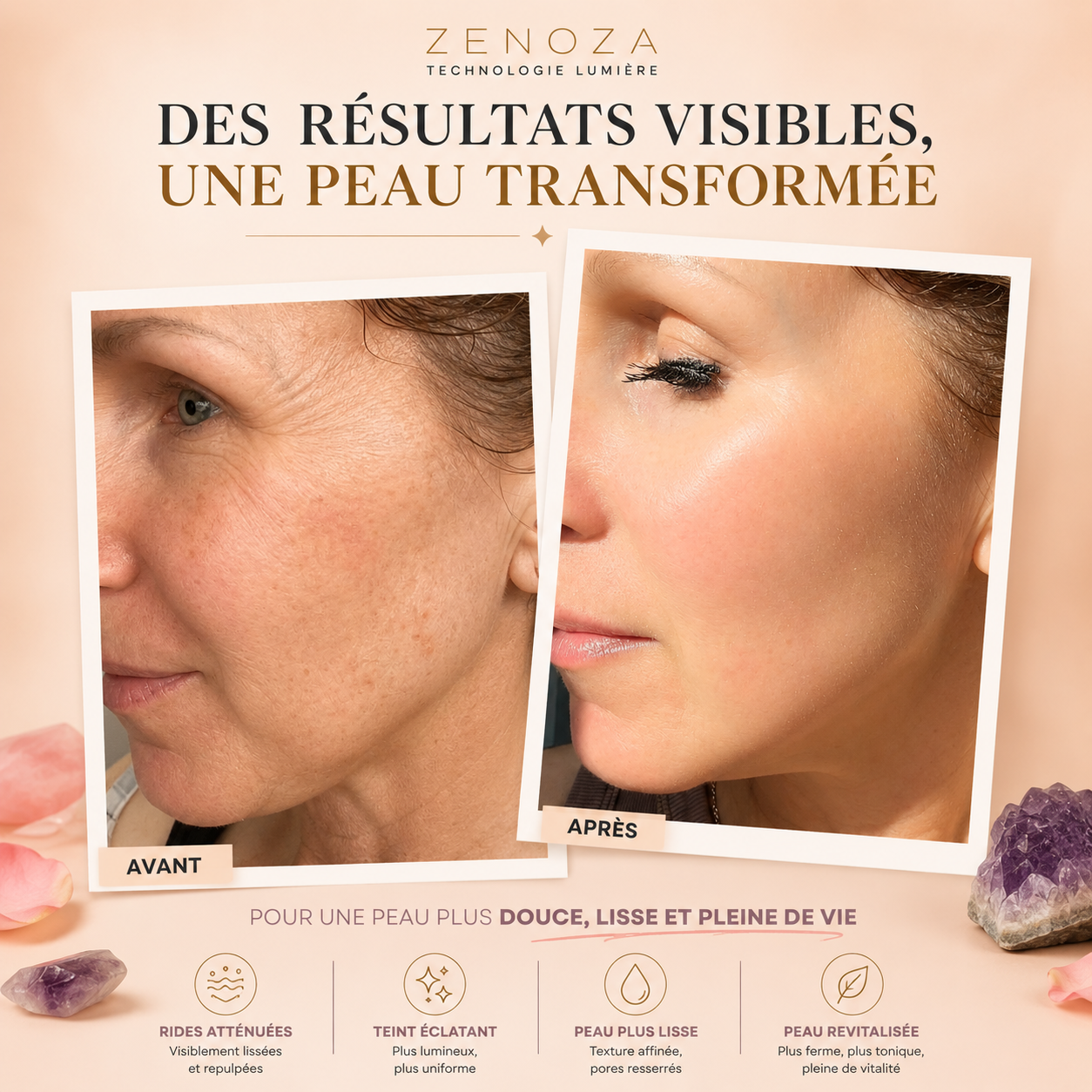 Masque LED Visage Zenoza - Anti-âge, Anti-acné