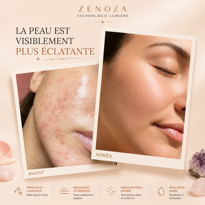 Masque LED Visage Zenoza - Anti-âge, Anti-acné