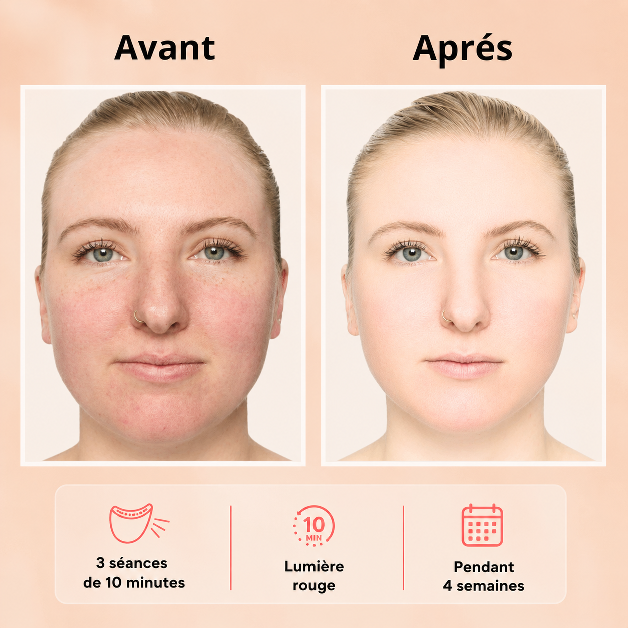 Masque LED Visage Zenoza - Anti-âge, Anti-acné