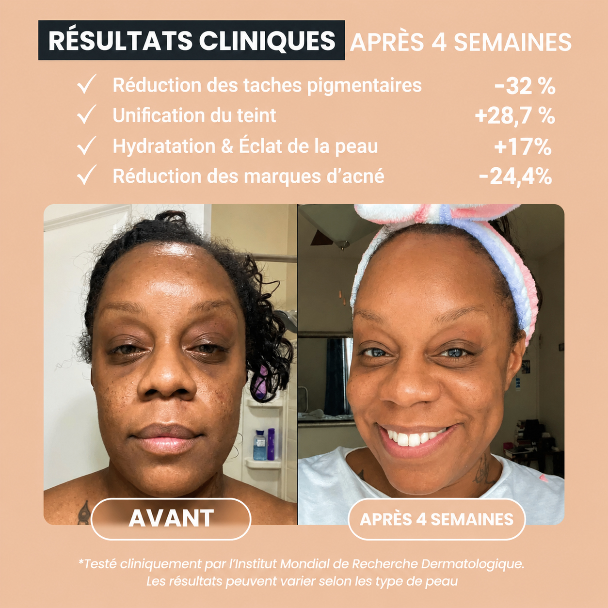 Savon Anti-Imperfections au Curcuma