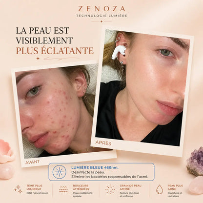 Masque LED Visage Zenoza - Anti-âge, Anti-acné