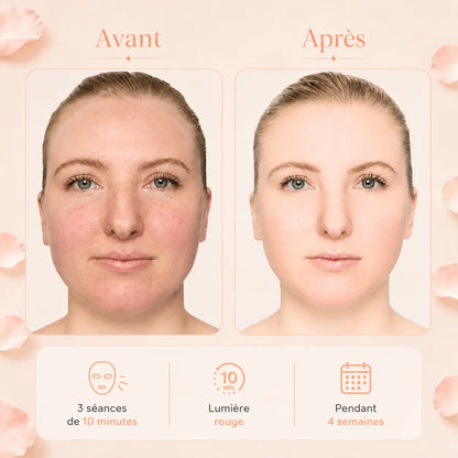 Masque LED Visage Zenoza - Anti-âge, Anti-acné