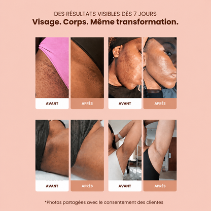 Savon Anti-Imperfections au Curcuma