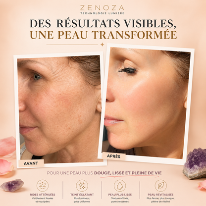 Masque LED Visage Zenoza - Anti-âge, Anti-acné